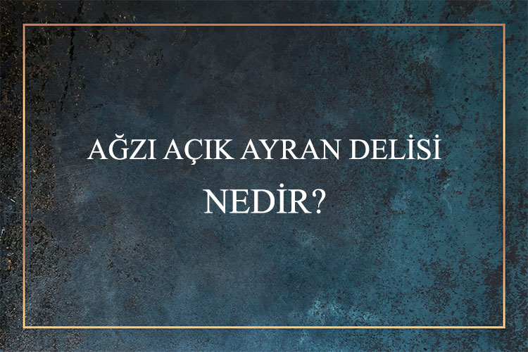 Ağzı Açık Ayran Delisi Nedir? 1