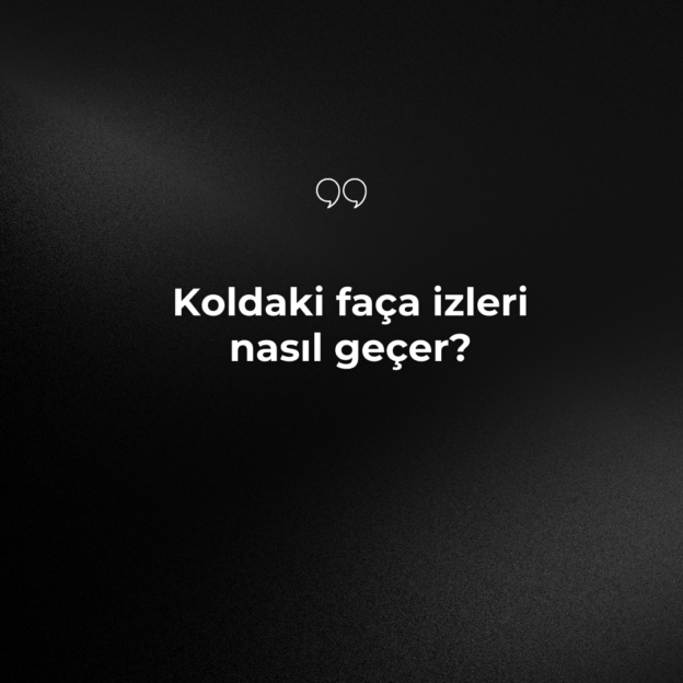 Koldaki faça izleri nasıl geçer? 1